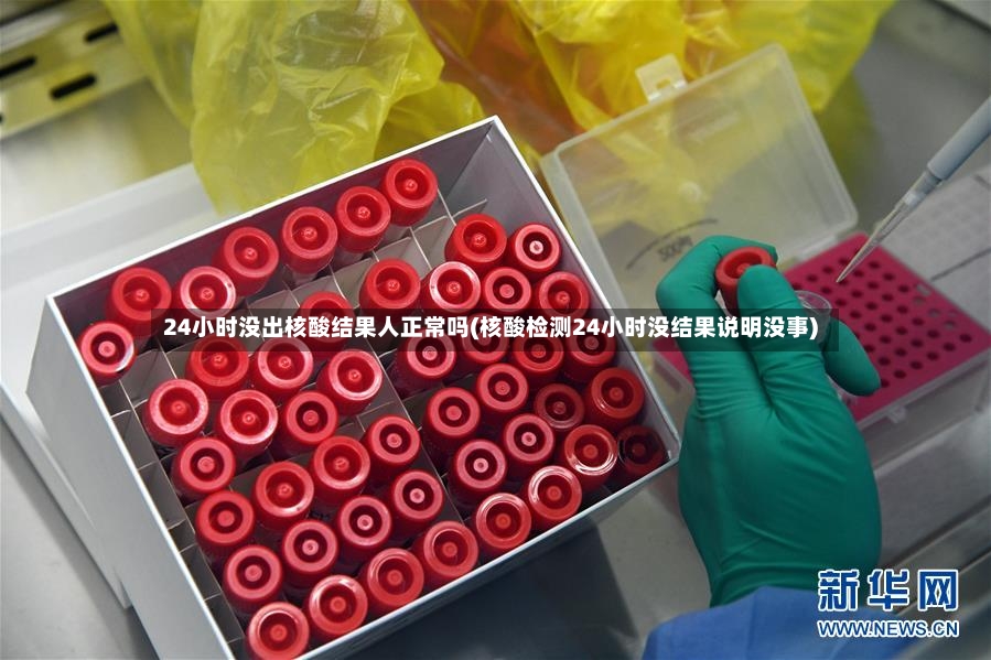 24小时没出核酸结果人正常吗(核酸检测24小时没结果说明没事)