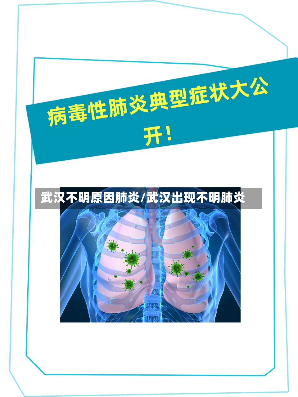 武汉不明原因肺炎/武汉出现不明肺炎-第2张图片