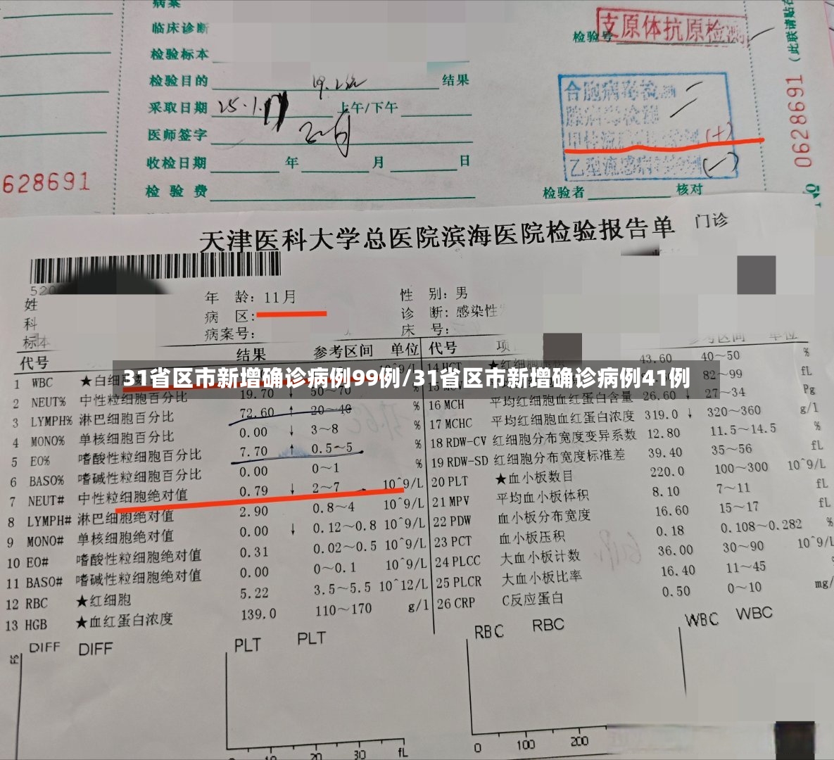 31省区市新增确诊病例99例/31省区市新增确诊病例41例-第2张图片