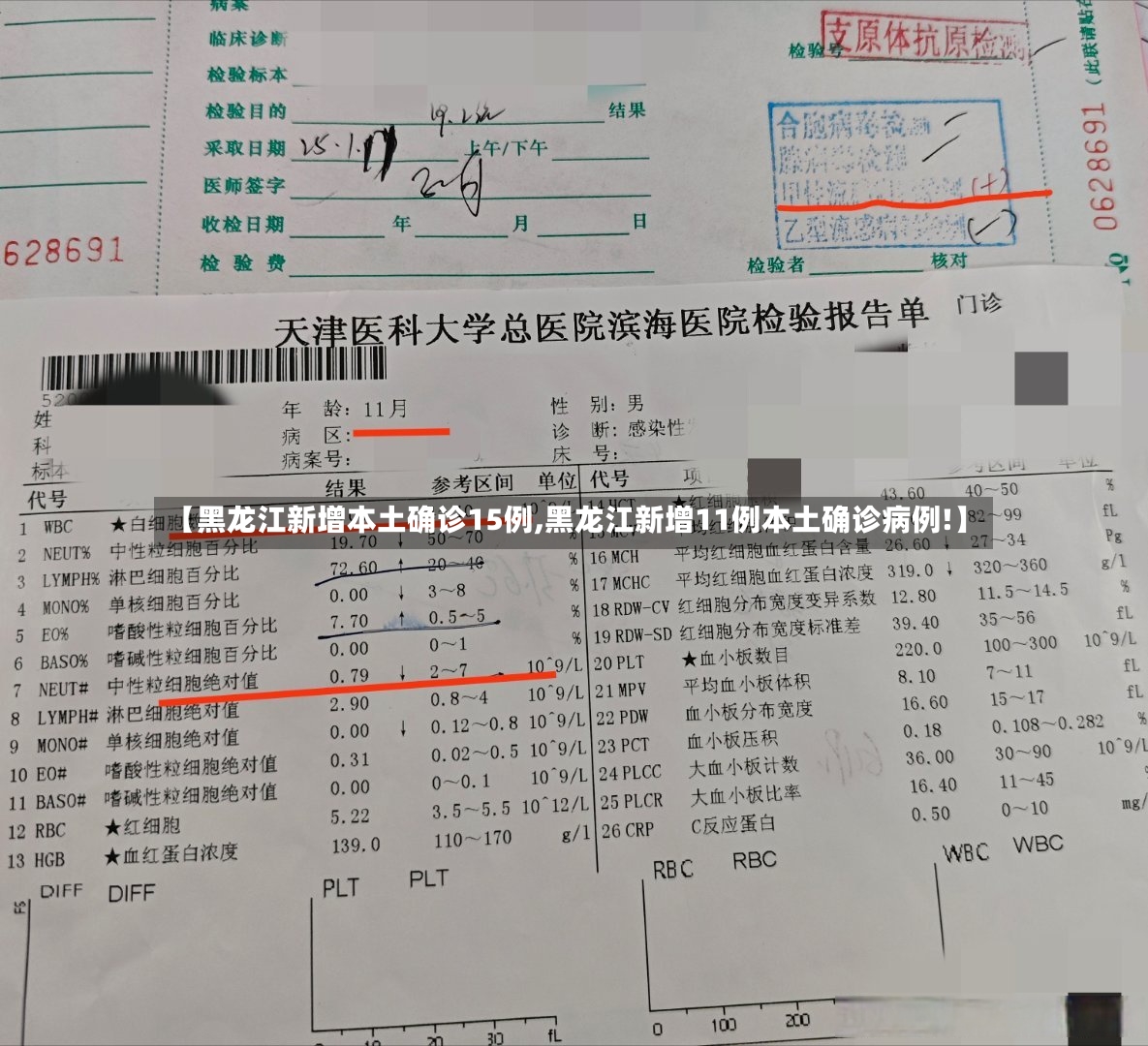 【黑龙江新增本土确诊15例,黑龙江新增11例本土确诊病例!】-第2张图片