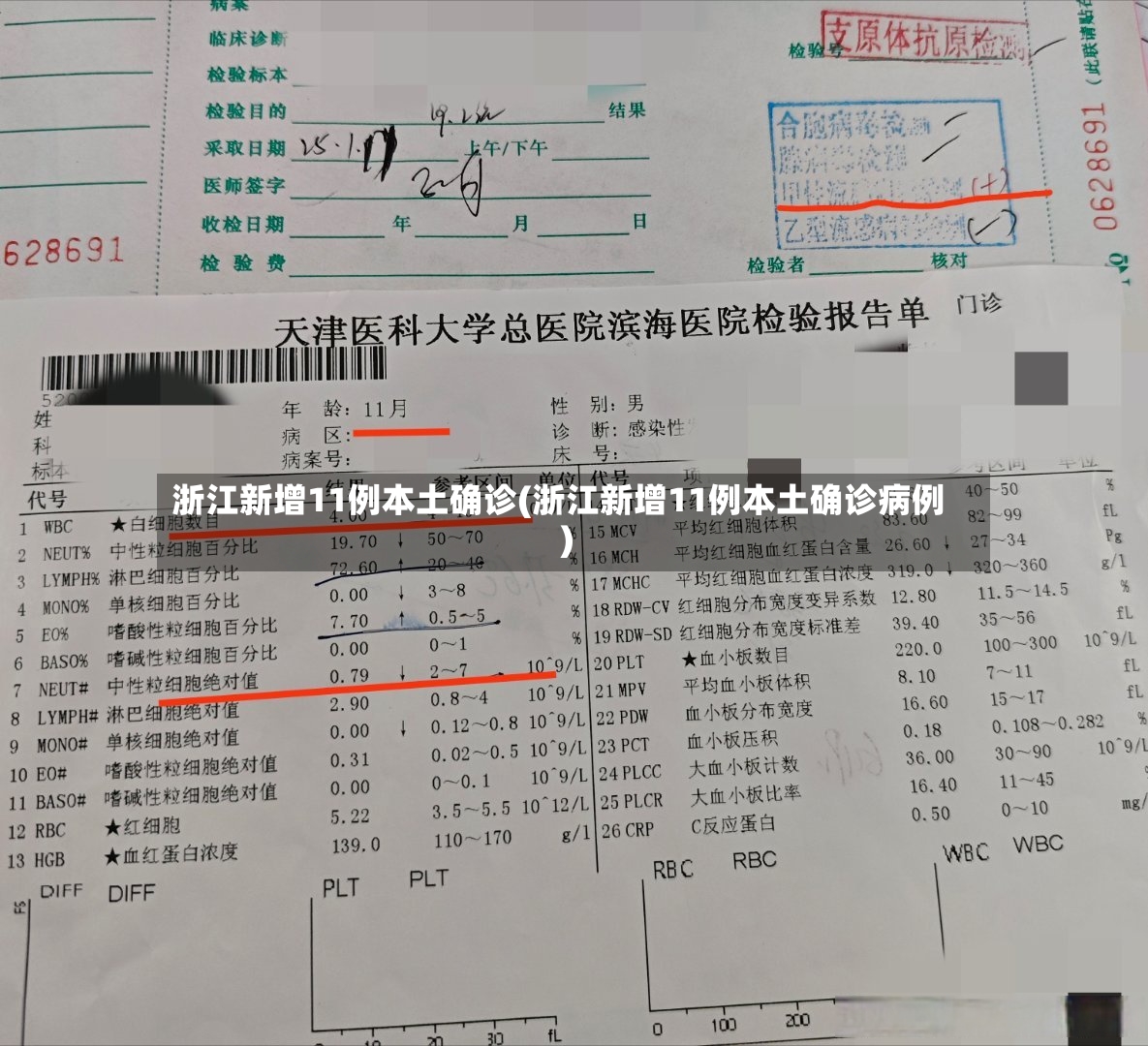 浙江新增11例本土确诊(浙江新增11例本土确诊病例)-第2张图片