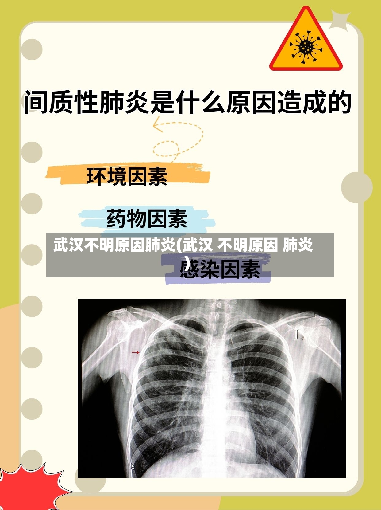 武汉不明原因肺炎(武汉 不明原因 肺炎)