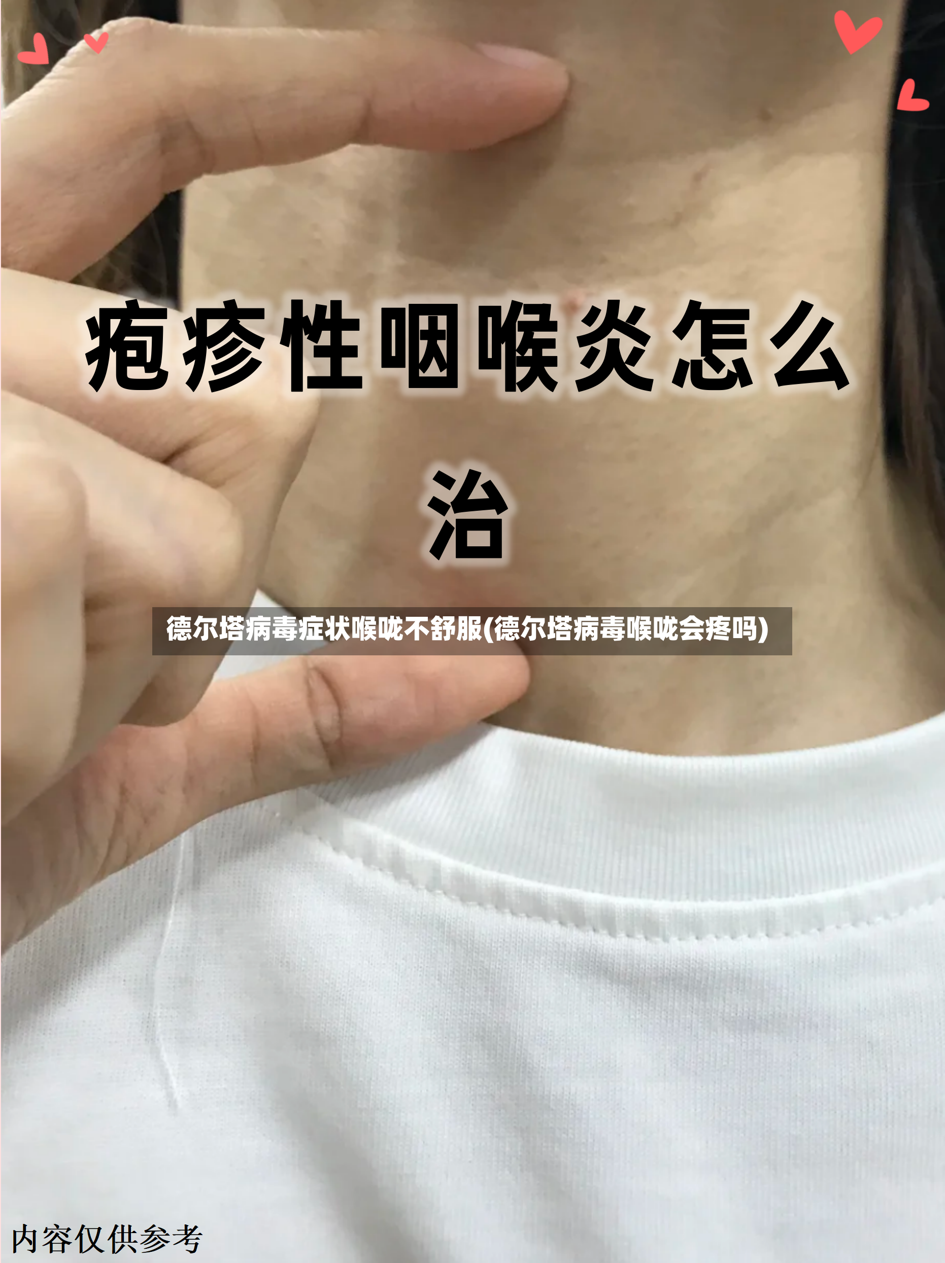 德尔塔病毒症状喉咙不舒服(德尔塔病毒喉咙会疼吗)-第2张图片